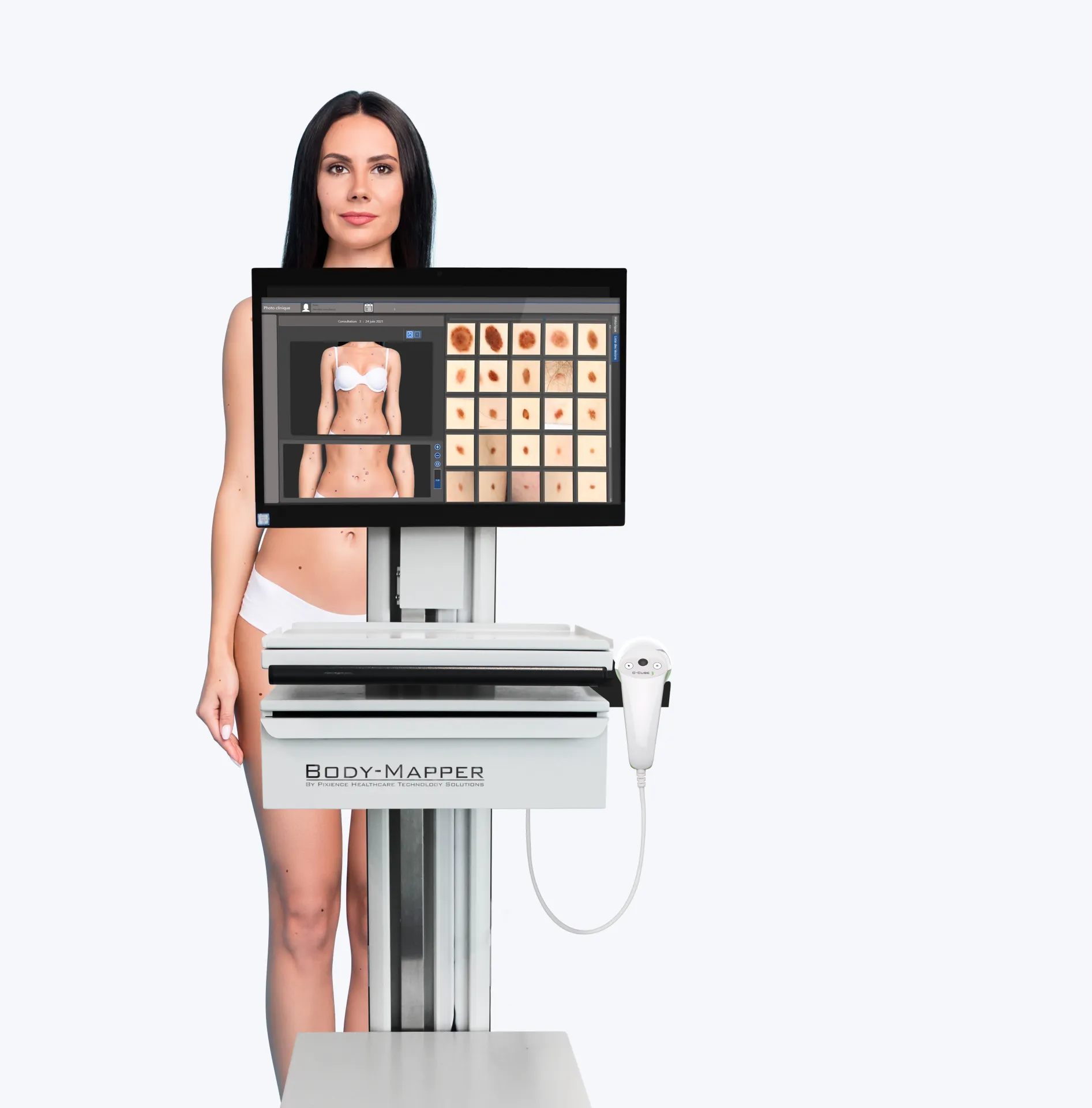Pixience s'est associé à Huvy pour intégrer ses briques logiciels d'IA dans ses solutions comme le BodyMapper. dermatologie