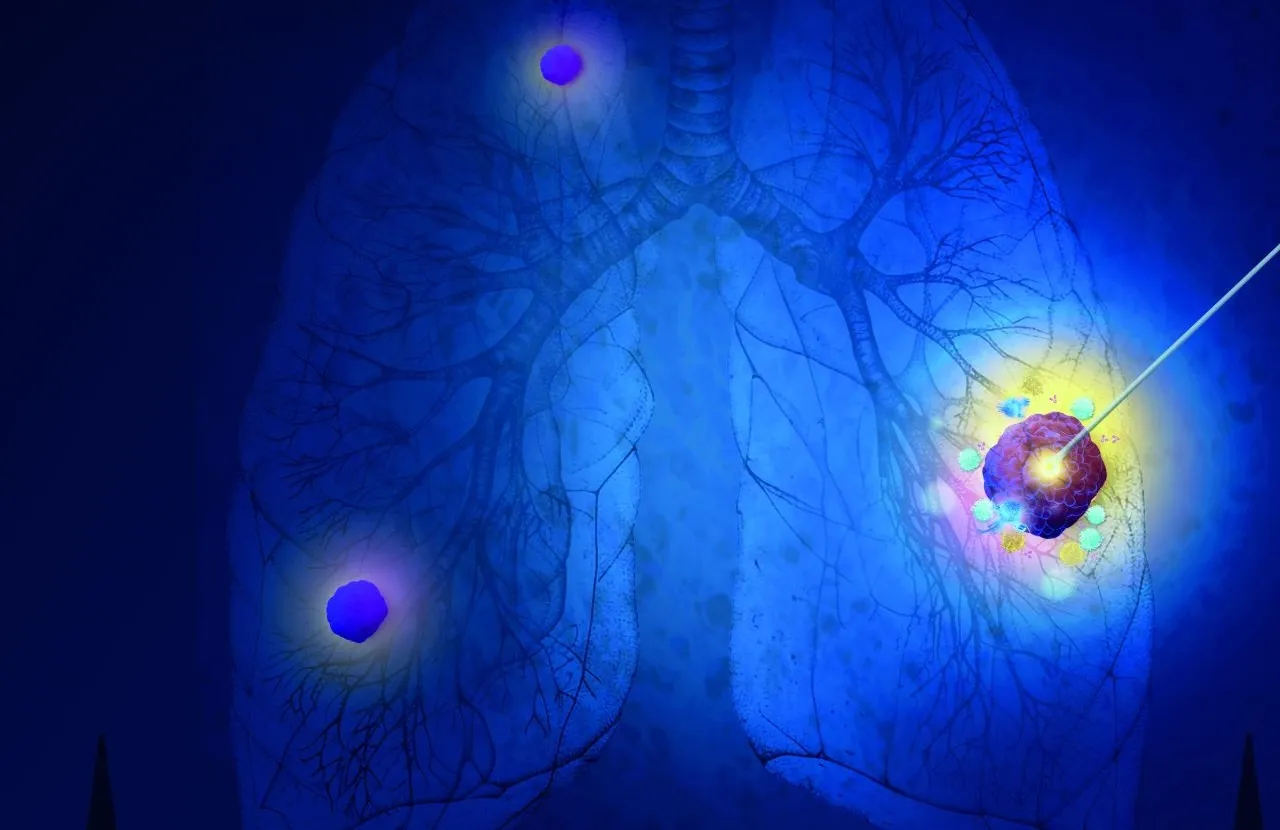 Étudiée par l'Institut Gustave Roussy, l’immunothérapie intratumorale cible la tumeur, réduit la toxicité et reprogramme l’immunité pour des traitements du cancer plus précis et efficaces. (Crédit : Institut Gustave Roussy / Bérengère Denfert)