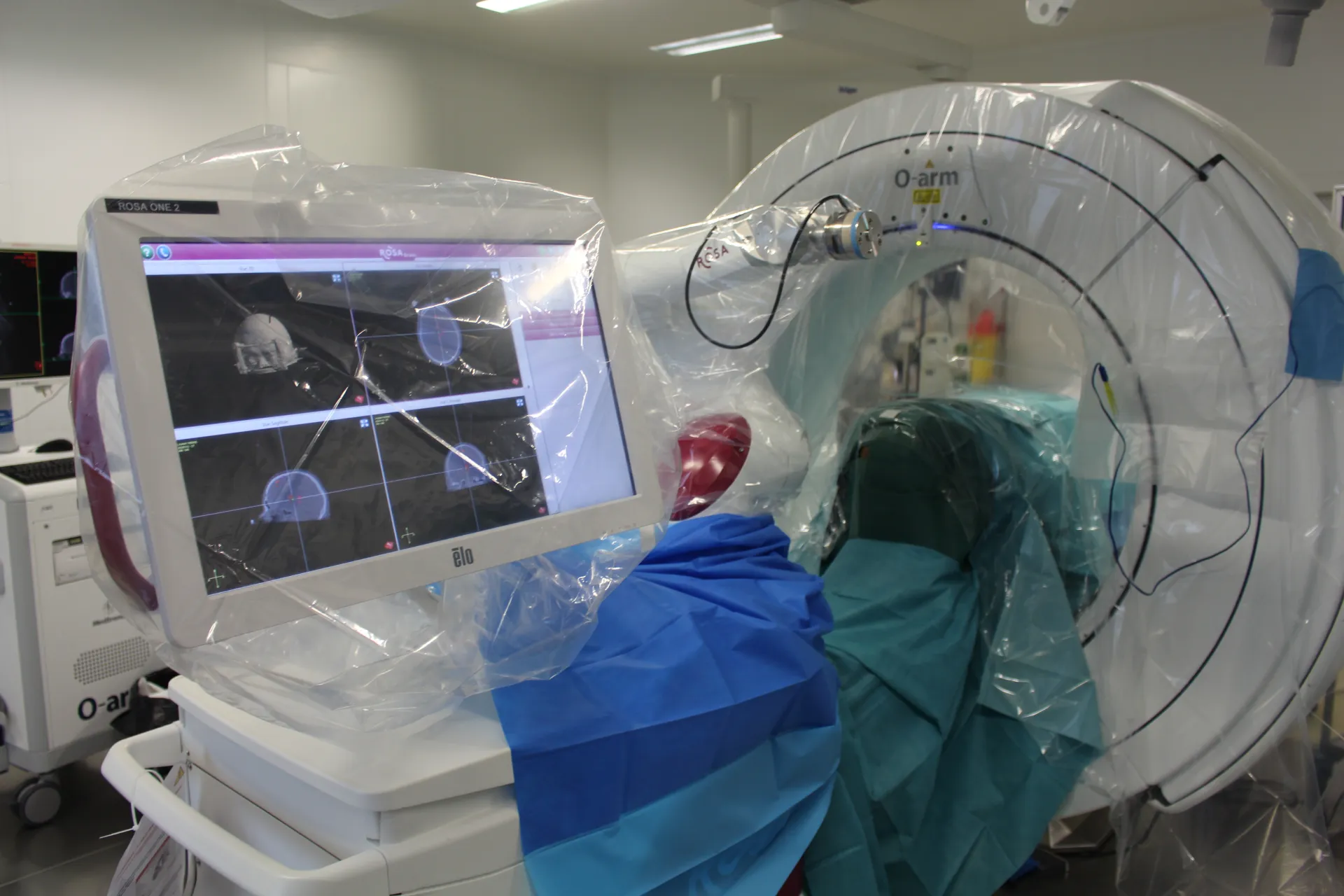 L’IRM permet de guider l’opération par thermothérapie laser, dans la prise en charge des patients souffrant de Parkinson. (Crédit : CHU d'Amiens)