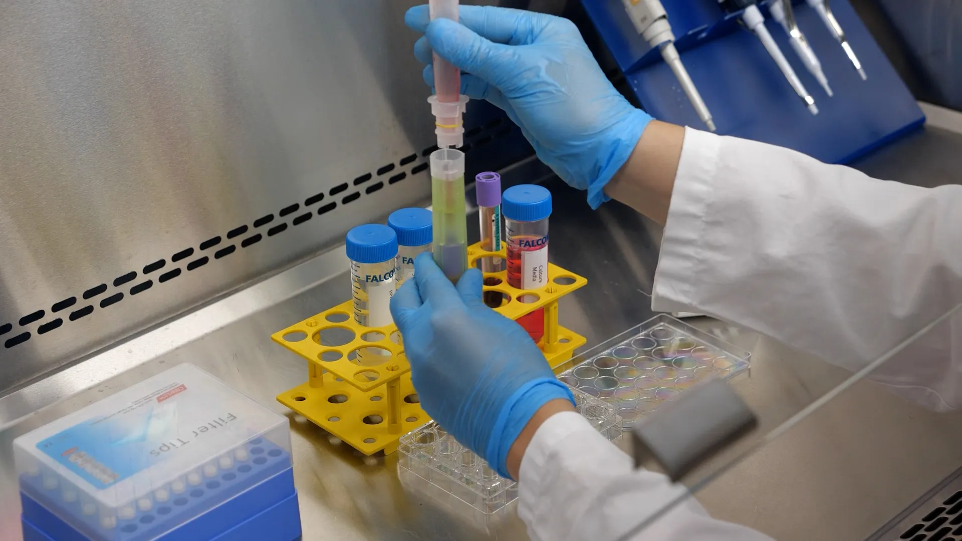 ScreenCell développe une filtration sanguine isolant les cellules tumorales circulantes pour mieux suivre et monitorer les cancers.