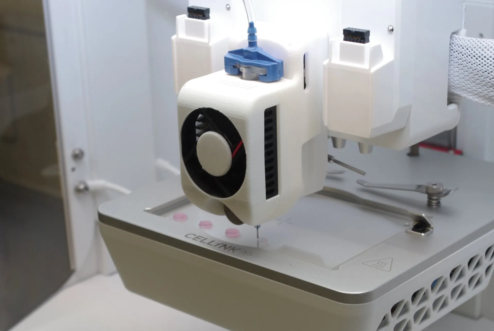 La bio-impression 3D de tumeurs pourrait accélérer la médecine de précision en testant les traitements directement sur des avatars.