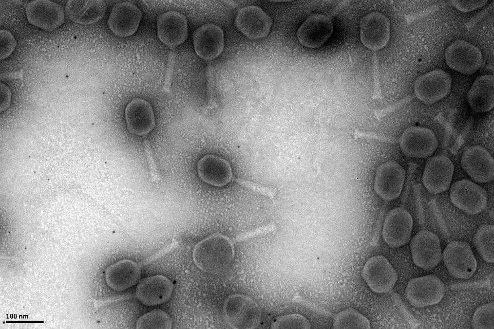 La phagothérapie consiste à produire en laboratoire des virus capables de cibler et détruire spécifiquement les bactéries pathogènes, ici des Staphylocoques dorés. (HCL)